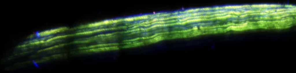 Sciatic Nerve imaged using our pdms intravital window.