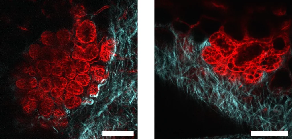 Lactating mammary gland